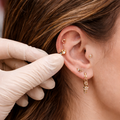 Piercing Removal